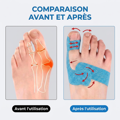 Stripex™ - Bande pour hallux valgus